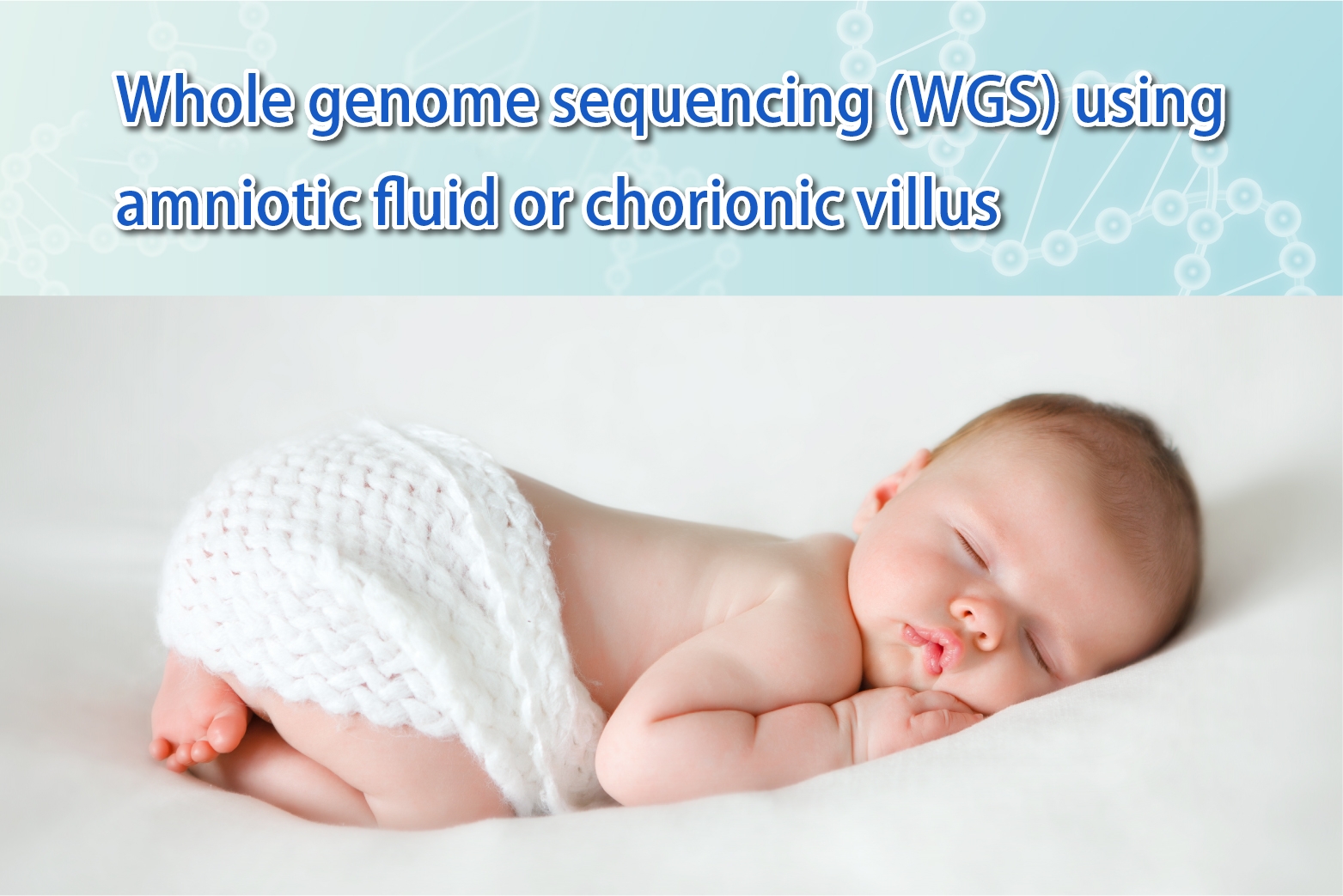 Whole genome sequencing(WGS)using
amniotic fluid or chorionic villus