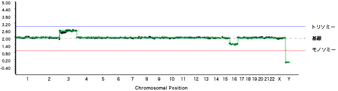 「グラフ3」3トリソミーのモザイク、16モノソミーのモザイク、女性（XX）