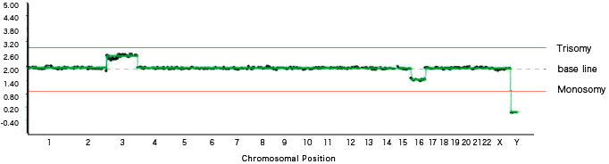 [Graph 3] 3 Trisomy Mosaic, 16 Monosomy Mosaic, female (XX)