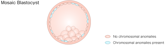 Mosaic Blastocyst